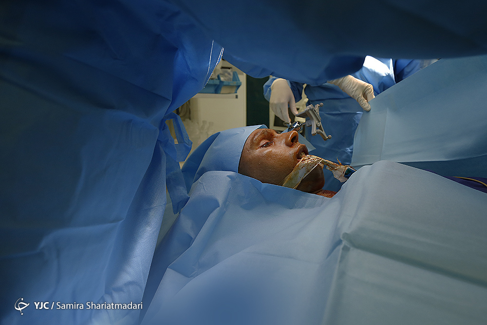 جراحی بازسازی کاسه چشم به کمک فناوری دانش بنیان ایرانی/ محققان کشور انحصار آمریکا و آلمان را شکستند