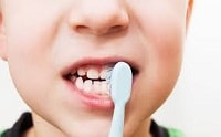 ارتقاء شاخص‌های سلامت دهان و دندان در مناطق زیر پوشش دانشگاه علوم پزشکی مشهد