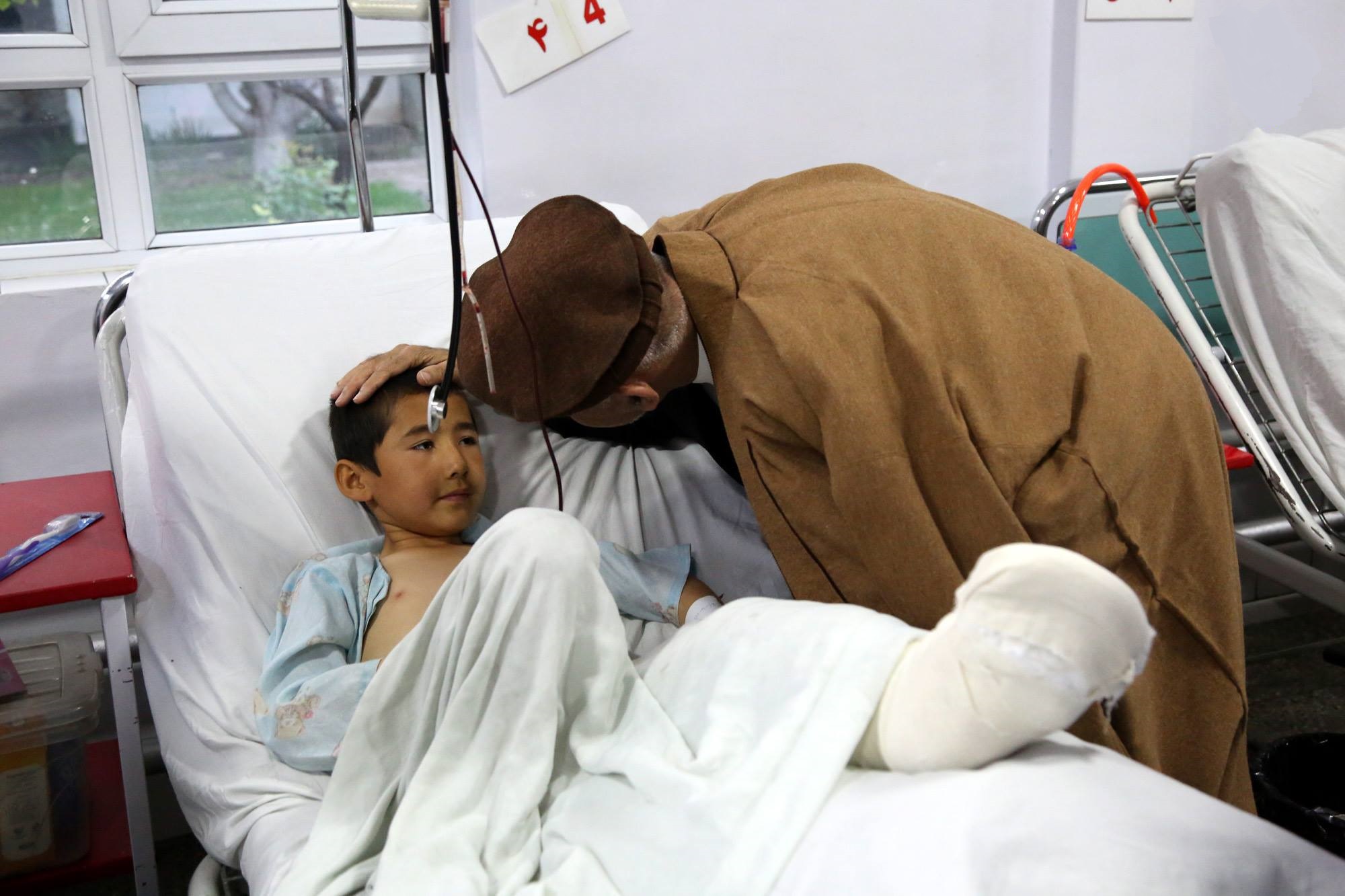 گزارش تصویری: عیادت «اشرف غنی» از مجروحین حمله تروریستی کابل