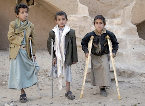 یمن، سرزمین جنگ خاموش کودکان