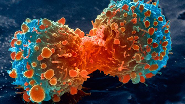 روش‌ درمانی مبارزه با سرطان به کمک سلول‌های خونی
