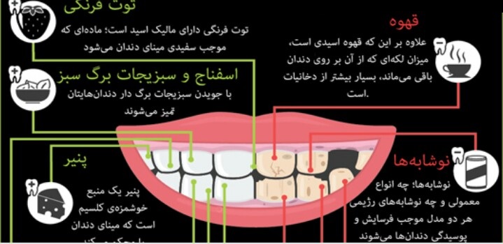 کدام مواد غذایی باعث پوسیدگی دندان می‌شود؟+ اینفوگرافی