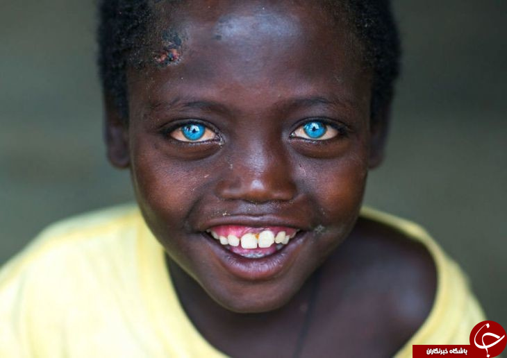 انتشار تصاویری از زیباترین کودکان چشم رنگی در فضای مجازی
