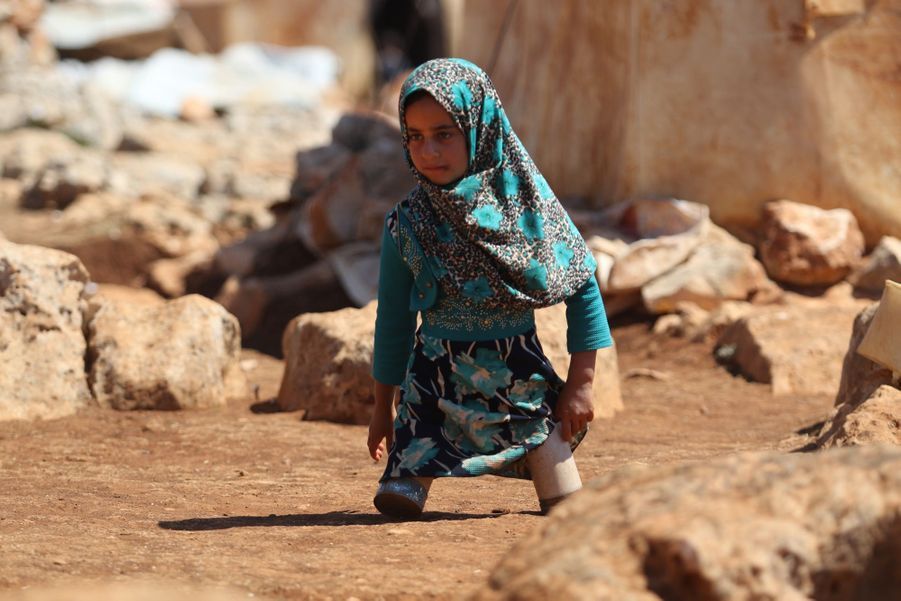 دختربچه سوری که بدون پا متولد شده بود پس از این راه می‌رود+ تصاویر