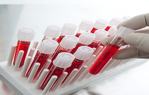 نگهداری سلول‌های بنیادی خون محیطی در کدام بیماری‌ها توصیه می‌شود؟