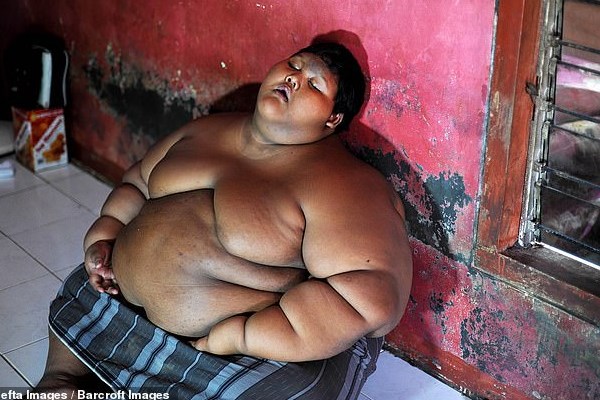 کاهش وزن چشمگیر و عجیب چاق‌ترین کودک دنیا + تصاویر
