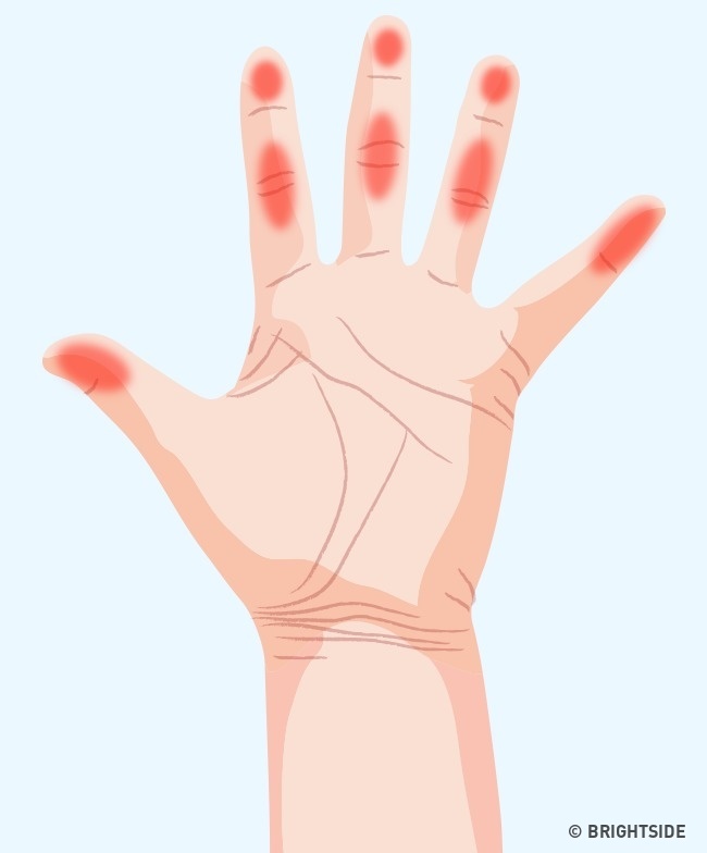 دست شما در مورد سلامت سرتاسر بدنتان چه می‌گوید؟ + تصاویر