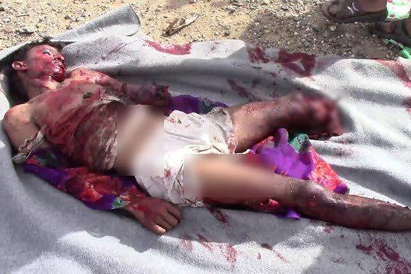 تصاویر دلخراش اجساد تکه‌شده مردم یمن در حمله ائتلاف متجاوز سعودی