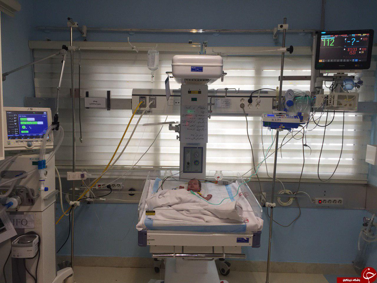 سنگین‌ترین جراحی قلب باز بر روی نوزاد١۴٠٠ گرمی +فیلم و تصاویر