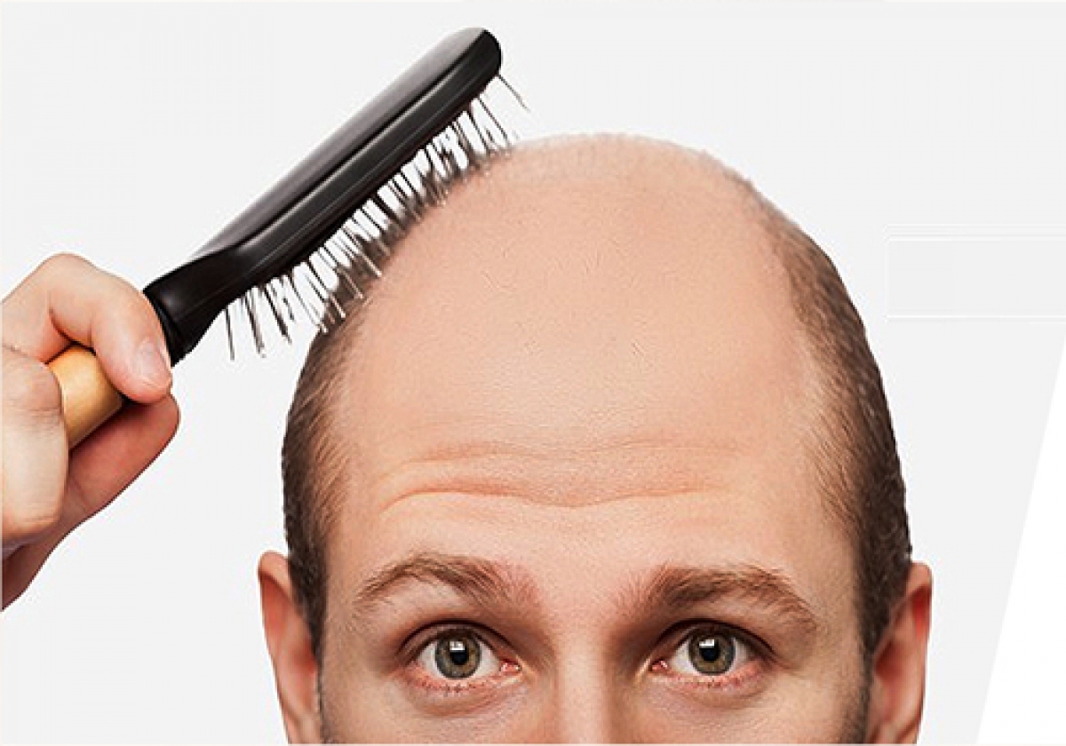 ساعت2بامداد/بماند/درمان ریزش مو با طب سنتی