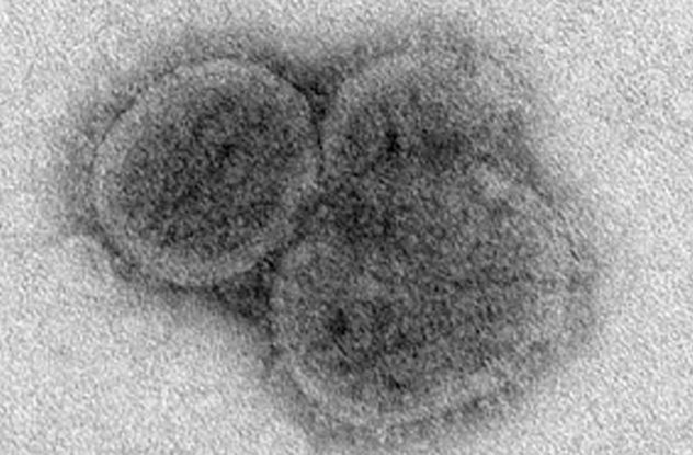 عجیب‌ترین ویروس‌ها / از ویروس عامل ناباروری تا ویروس‌هایی که به طرز مرموزی باعث فلج افراد می‌شوند
