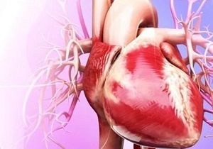 بیماری‌های قلبی عروقی یکی از شایع‌ترین علل مرگ و میر