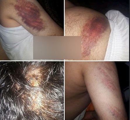حمله خانواده دانش آموز شلاق خورده به معلم +تصاویر(18+)