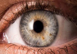 لکه‌های روی عنبیه چشم ، چه چیزی درمورد سلامتتان می گوید؟ + فیلم