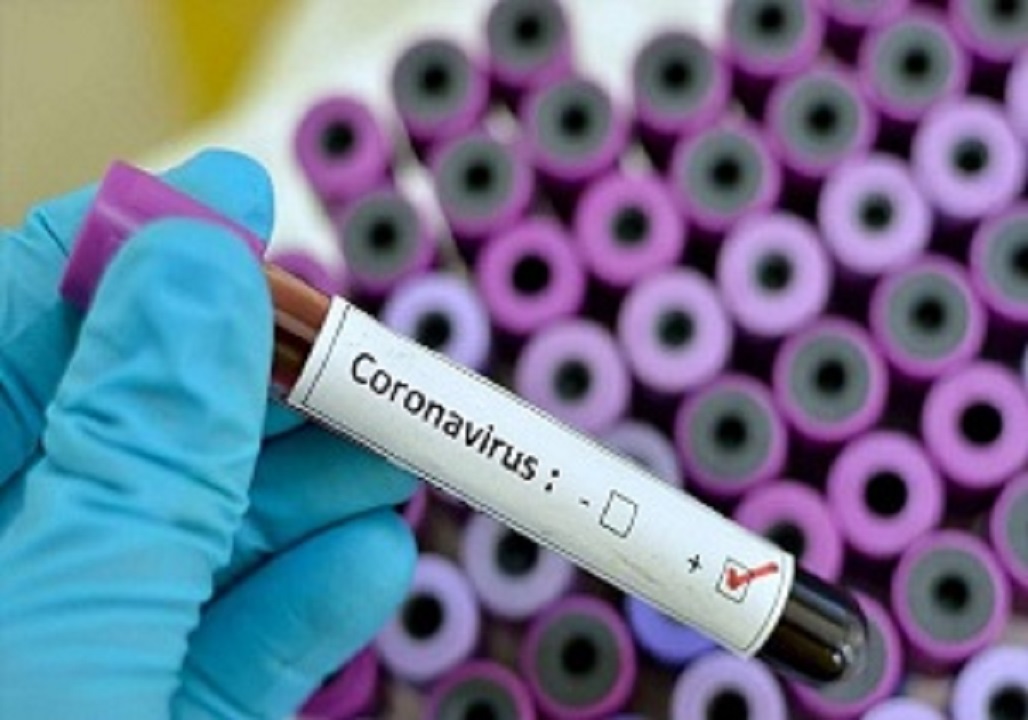 شمار مبتلایان به ویروس کرونا در افغانستان به ۵۵۵ نفر رسید