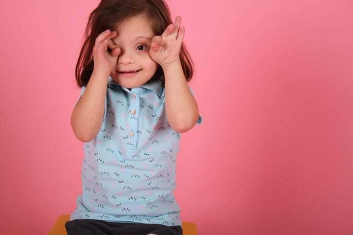 مدلینگ شدن کودک مبتلا به سندرم داون + تصاویر