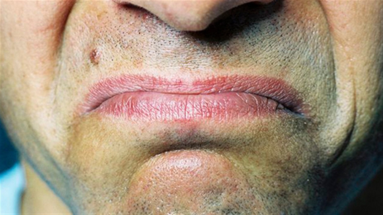 Металлический привкус во рту у мужчин причины. Металлический привкус во рту.