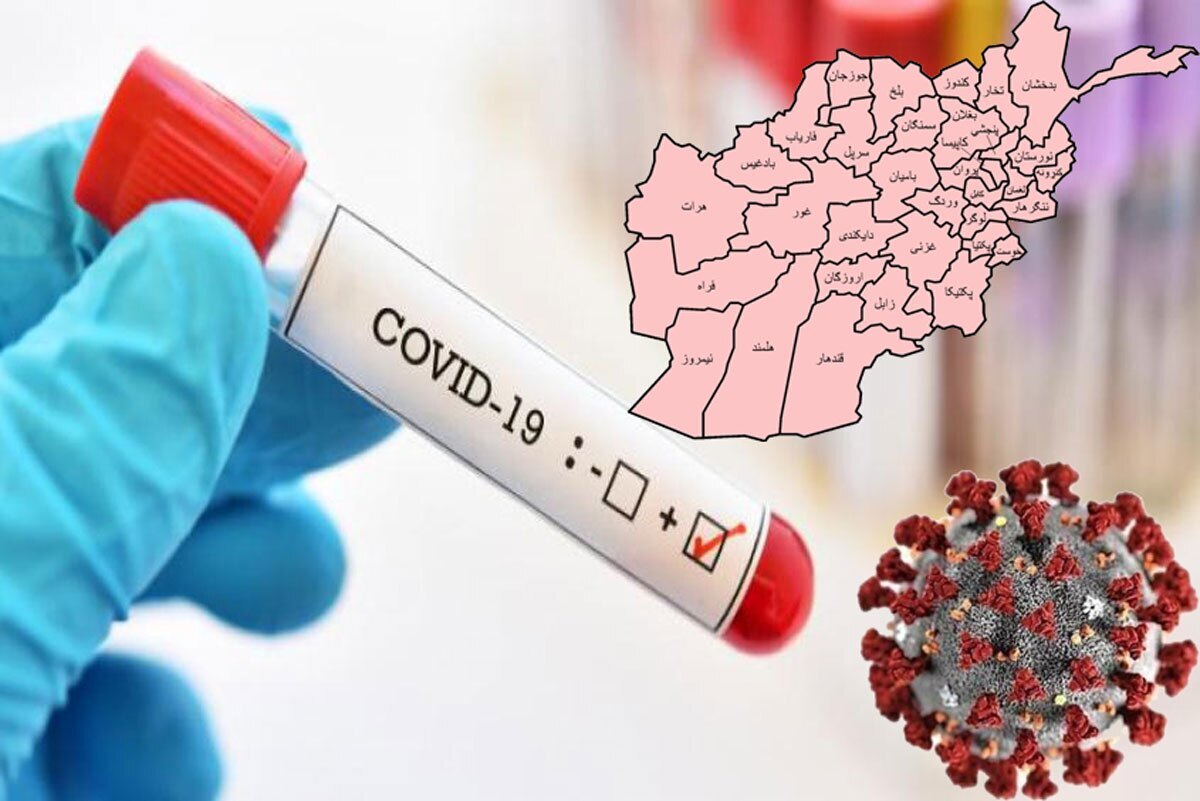 شمار مبتلایان به ویروس کرونا در افغانستان به ۵۵ هزار و ۷۷۶ تن رسید‌
