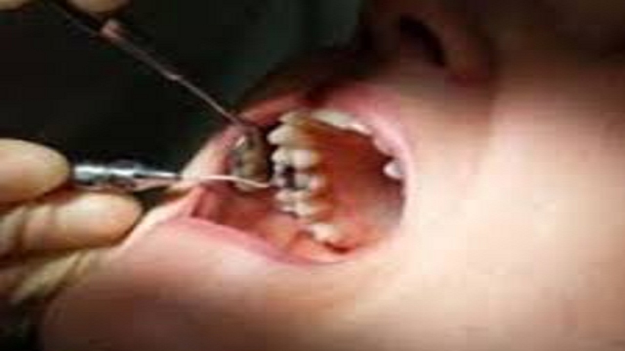 به خطر افتادن سلامتی افراد با مراجعه به مطب دندان پزشکان تجربی