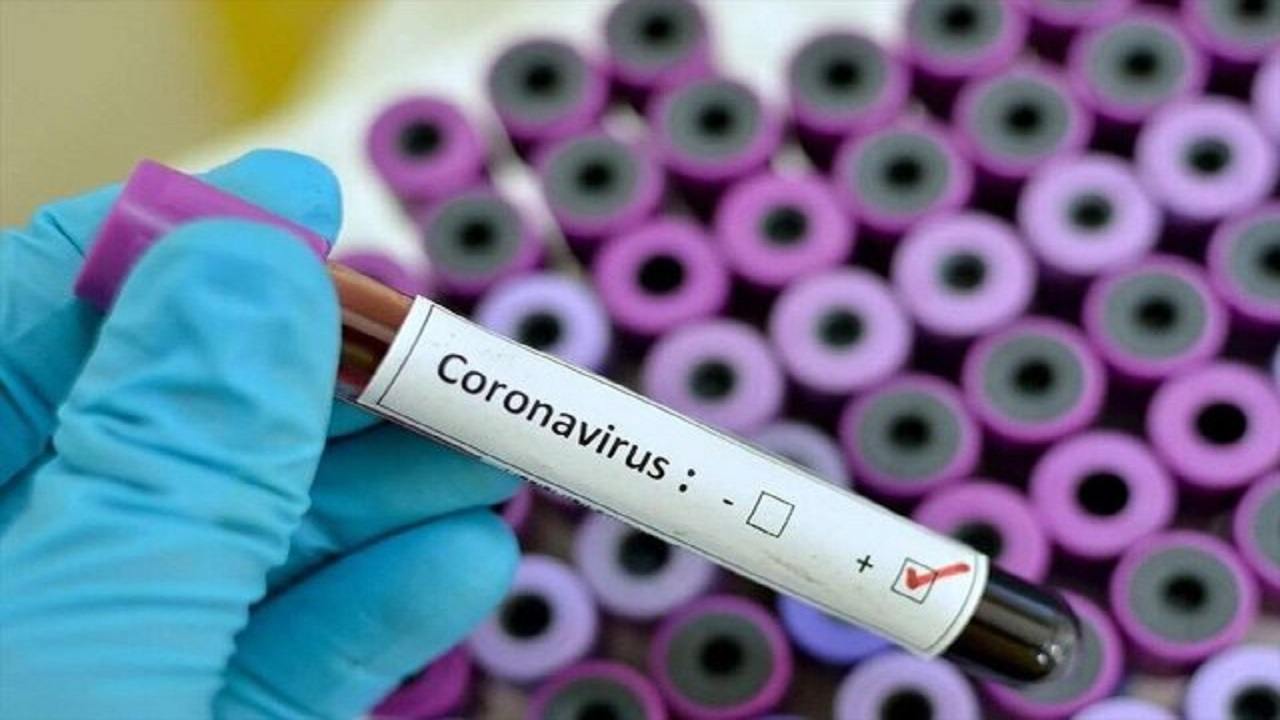 ۴۵۲ نفر از مبتلایان به ویروس کرونا در سمنان بهبود یافتند