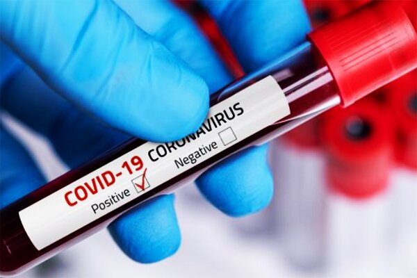 شناسایی۷۲ مورد جدید مبتلا به کرونا ویروس در ایلام