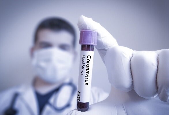 شناسایی ۸۸ مورد جدید مبتلا به کرونا ویروس در ایلام