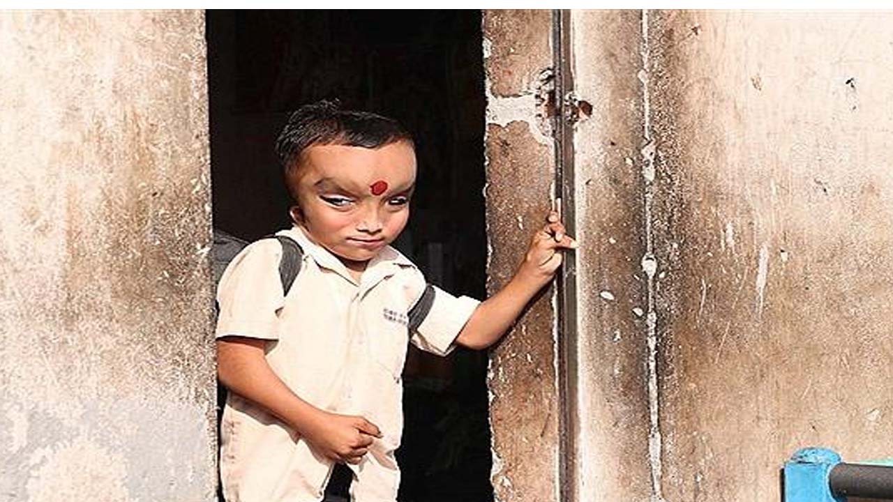رفتار مردم هند با پسر بچه عجیب الخلقه خبر ساز شد + تصاویر