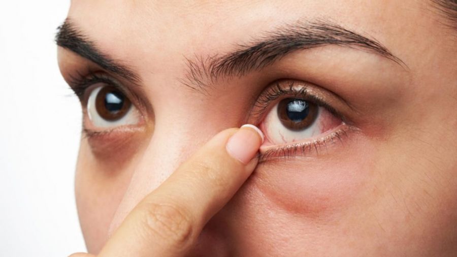 عواملی که در بروز خشکی چشم موثر هستند