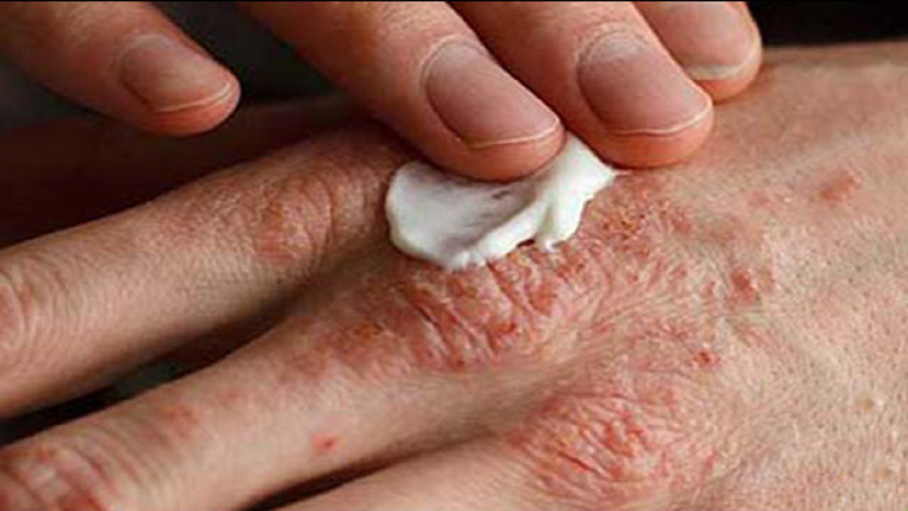 ۱۰ نکته مهم برای داشتن پوست سالم در فصل سرما
