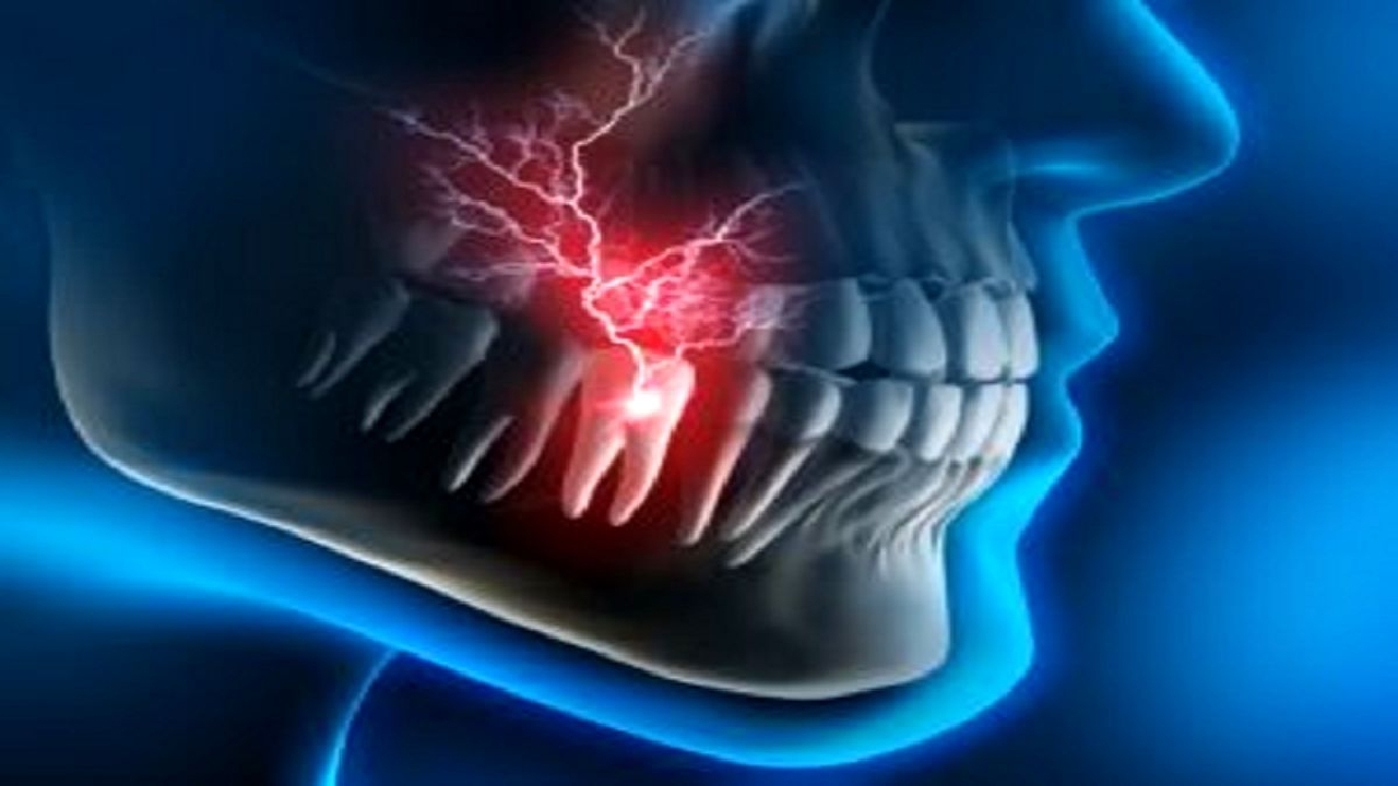 عصاره چه گیاهی عفونت ریشه دندان را از بین می‌برد؟