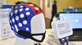 باشگاه خبرنگاران -ابداع کلاه هوشمند برای درمان بیماری‌های مغزی