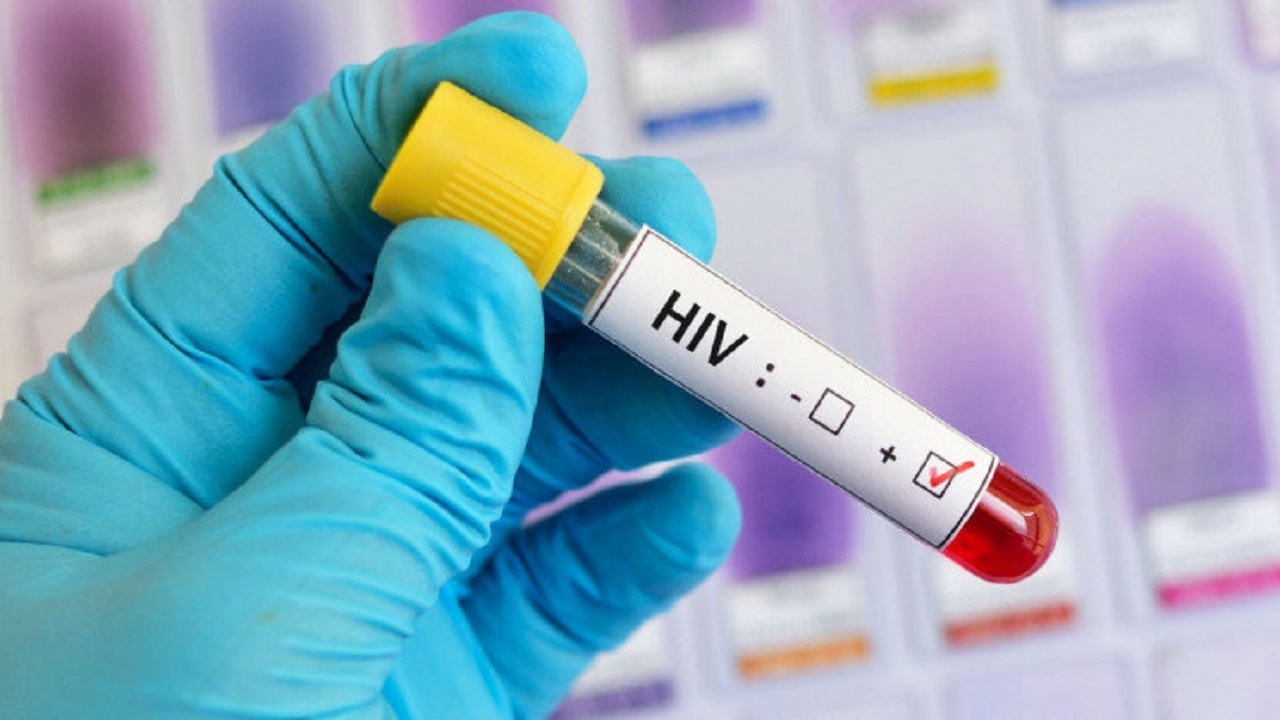 ارائه خدمات درمانی رایگان به بیماران مبتلا به عفونت اچ آی وی(HIV) در هرمزگان