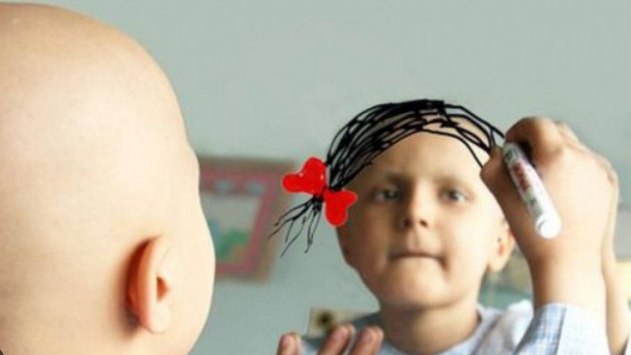 تنها یک درصد کل سرطان‌ها مربوط به کودکان است