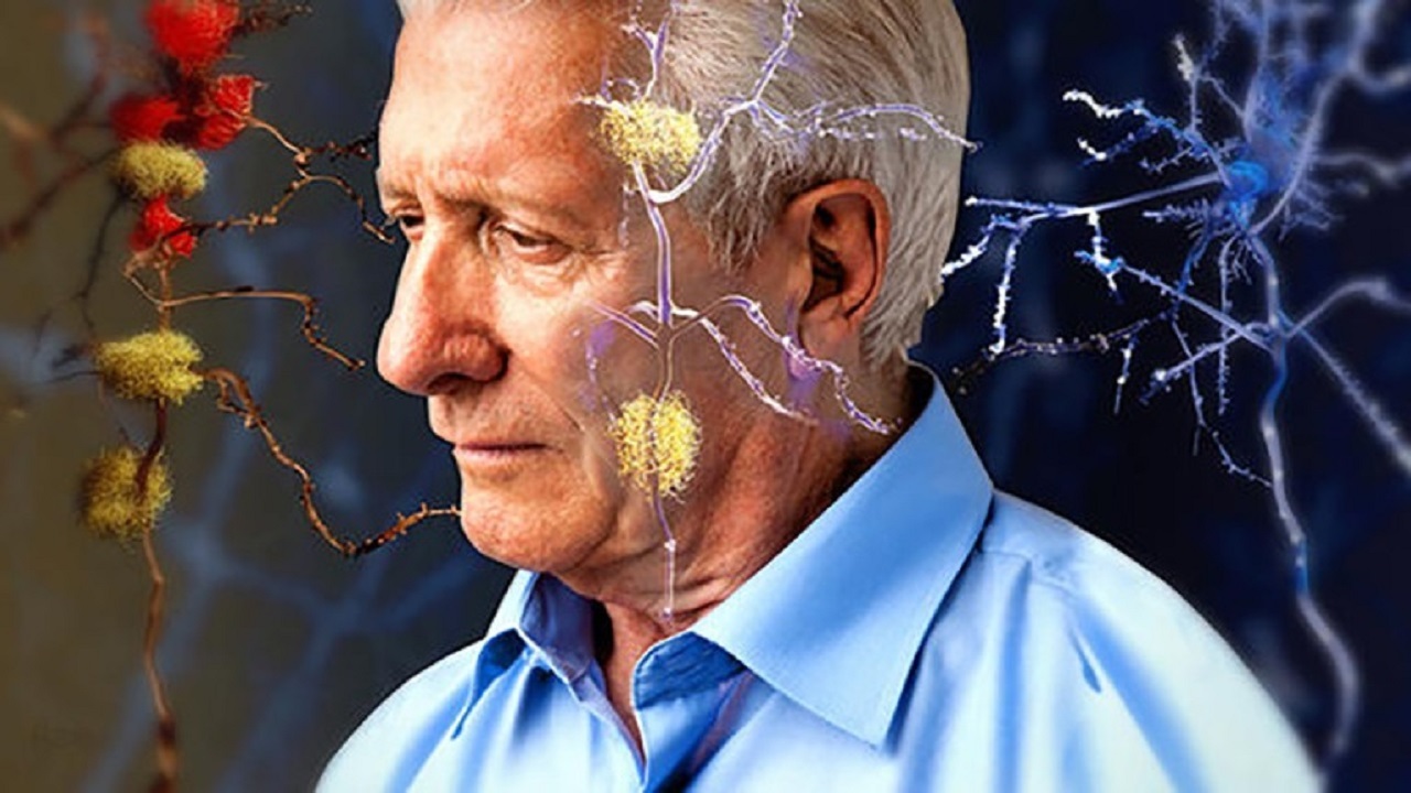 درمانی برای بیماران آلزایمری با سالم‌سازی سلول‌های آسیب دیده