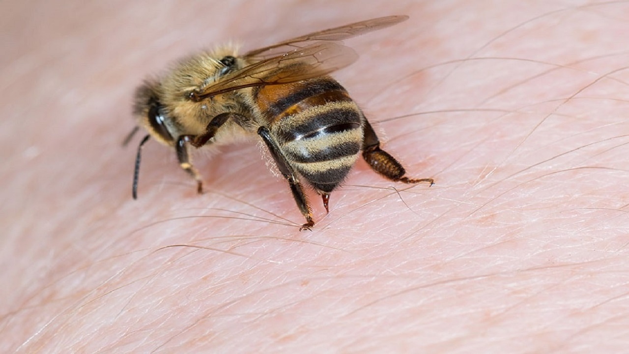 زنبور گزیدگی را جدی بگیرید! + فیلم