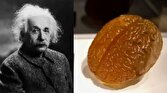 - مغز آلبرت اینشتین در شیشه؛ چه تفاوتی با مغز دیگران مشاهده شد؟
