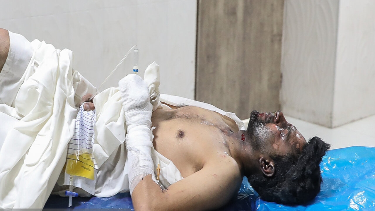 ۱۹ مورد آسیب به چشم بر اثر حوادث چهارشنبه سوری در فارس