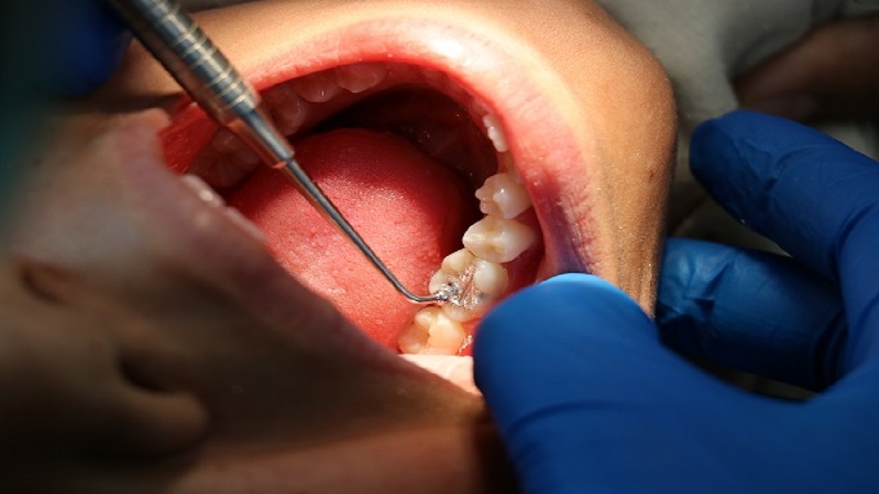 ارائه خدمات دندانپزشکی رایگان به برخی گروه‌های هدف در مناطق روستایی دزفول

 