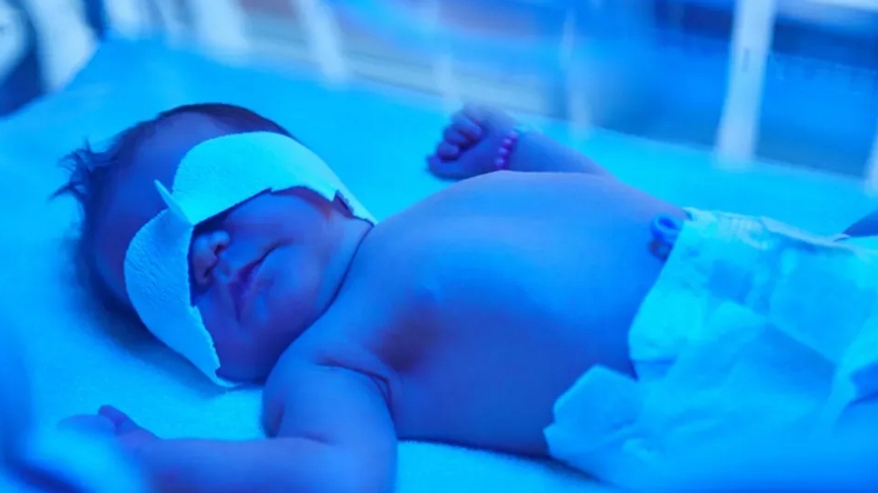 هوشمندسازی دستگاه درمان زردی نوزاد