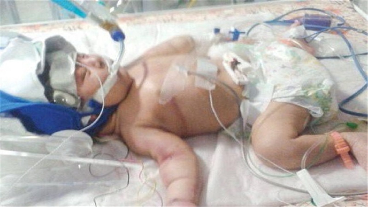 فوت یک نوزاد در بیمارستان علیمرادیان نهاوند/ خانواده نوزاد نبود دارو و غیبت پزشک را مقصر می‌دانند