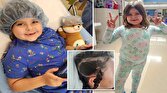 باشگاه خبرنگاران -عمل جراحی ۱۰ ساعته برای خاموش کردن نیمی از مغز دختر ۶ ساله