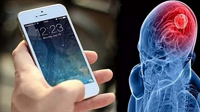 - تلفن همراه چه تاثیری روی مغز می‌گذارد؟