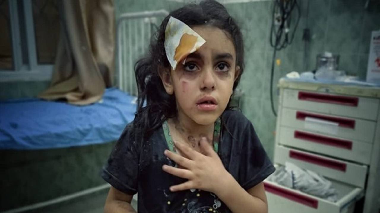 هلند: آماده پذیرش کودکان بیمار فلسطینی هستیم