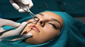 جراحی زیبایی.افزایش جراحی زیبایی مردان - واکاوی پدیده گرایش افراطی به جراحی‌های زیبایی