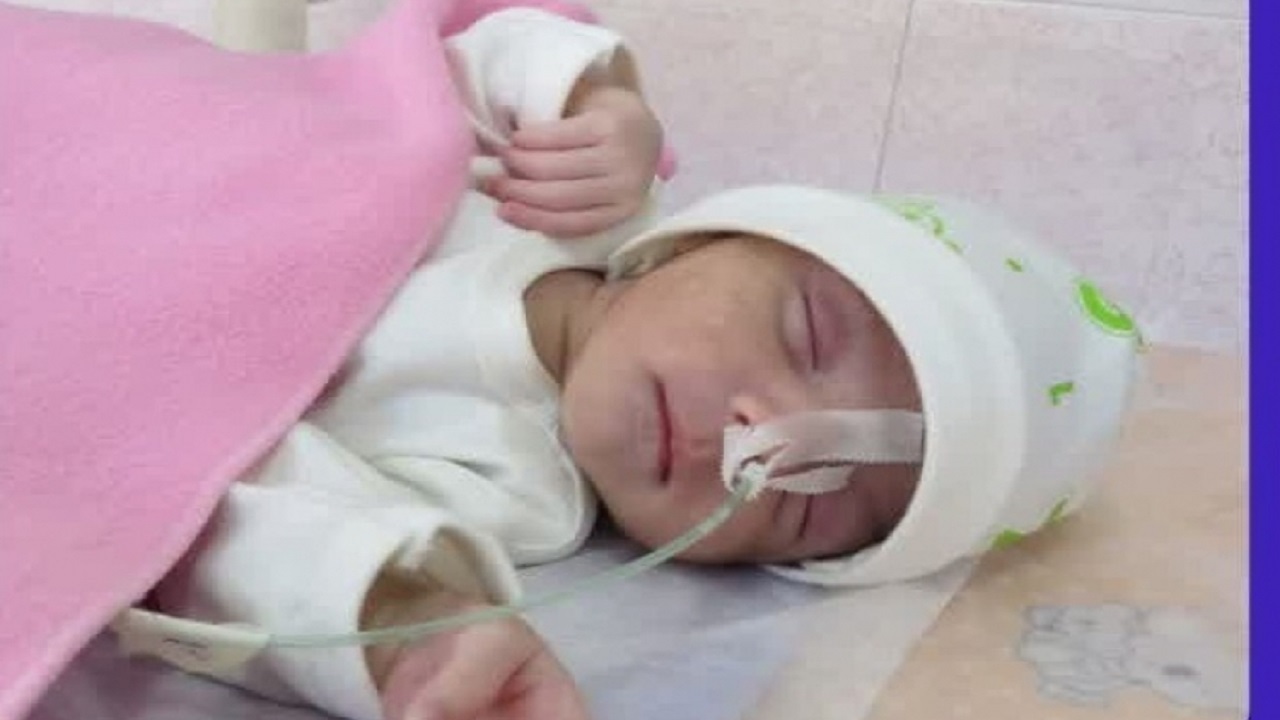انجام عمل جراحی فتق دیافراگم بر روی نوزاد ۲ روزه در اصفهان