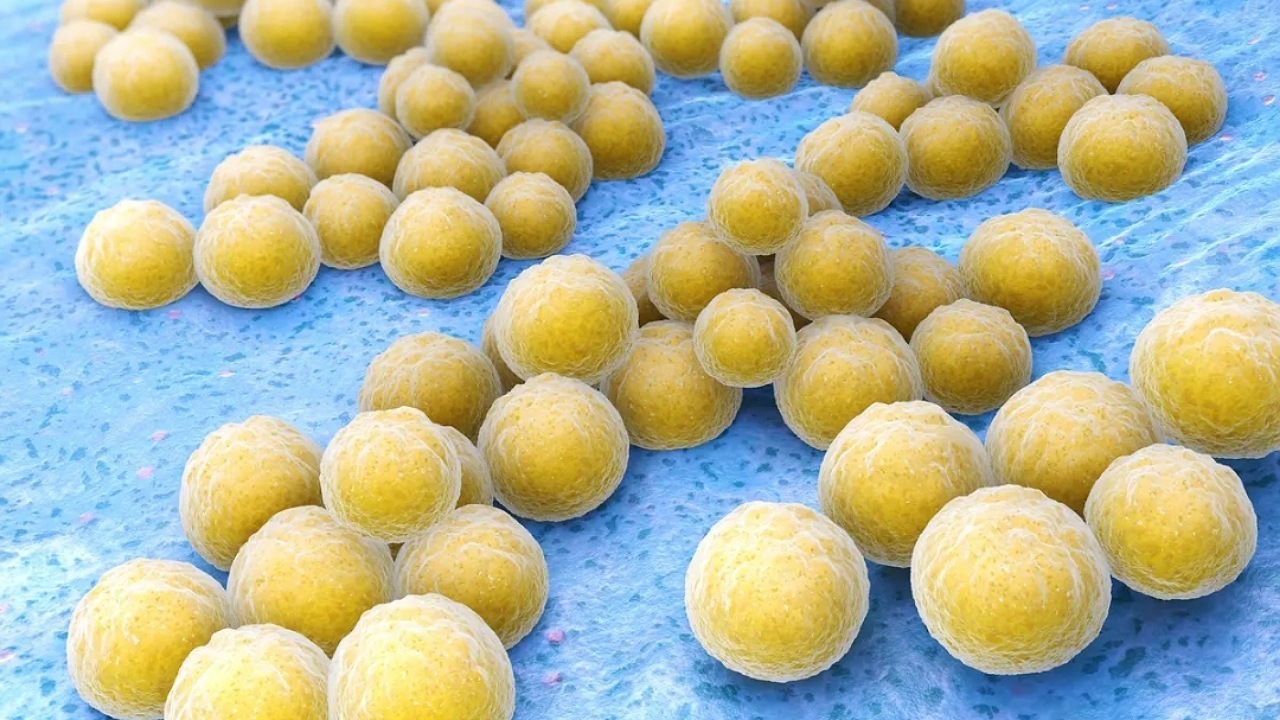 شیوع یک نوع عفونت باکتریایی در ژاپن