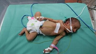 باشگاه خبرنگاران -شهادت نوزاد نجات یافته از شکم مادر شهید + فیلم