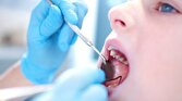 باشگاه خبرنگاران -بیماری‌های دهان و دندان یکی از شایعترین بیماری‌های غیرواگیر است