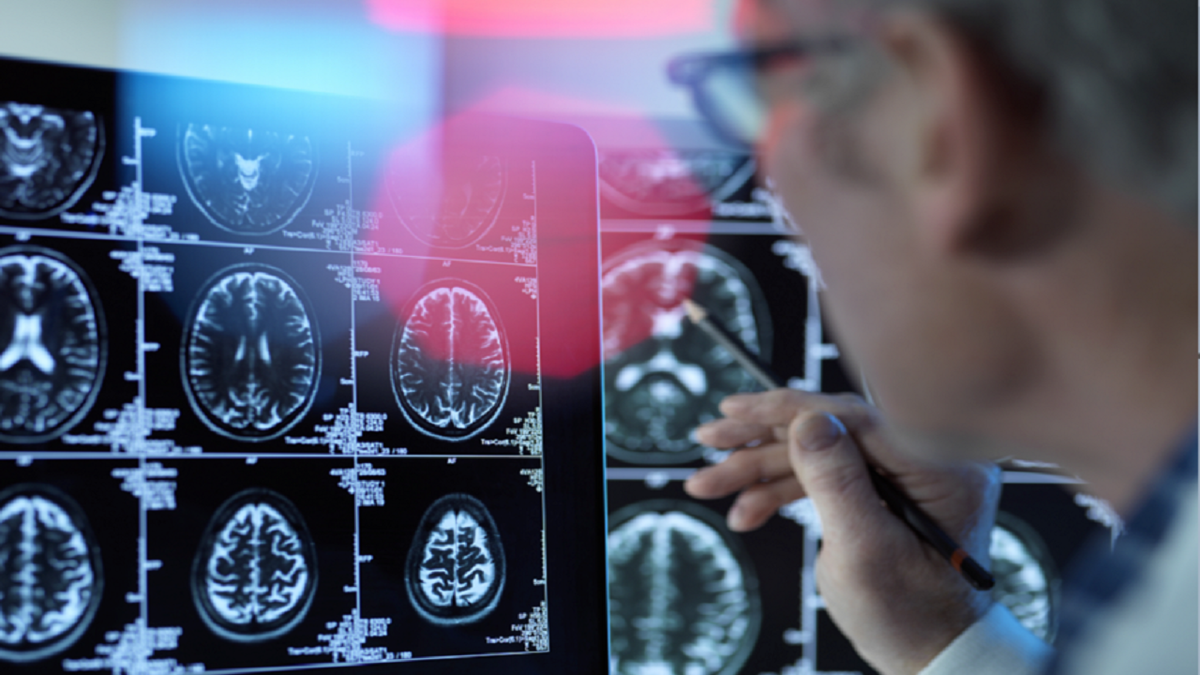 باشگاه خبرنگاران -علامت‌های هشدار دهنده در میانسالی برای زوال عقل در مراحل بعدی 