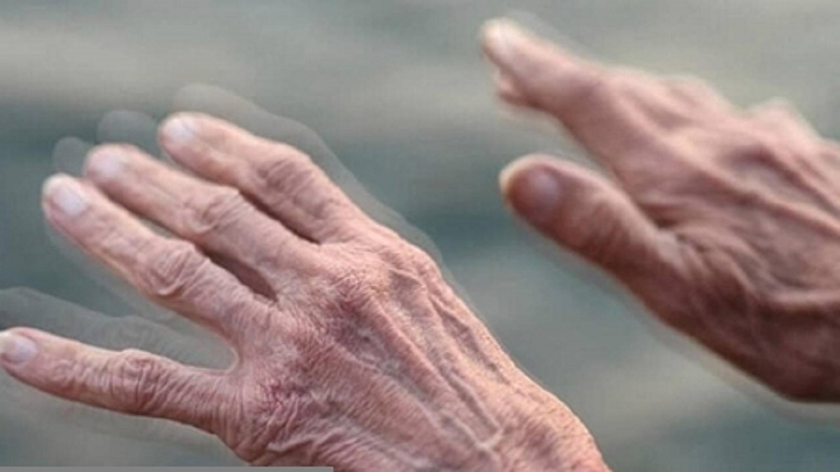 باشگاه خبرنگاران -درکی جدید در مورد بیماری پارکینسون